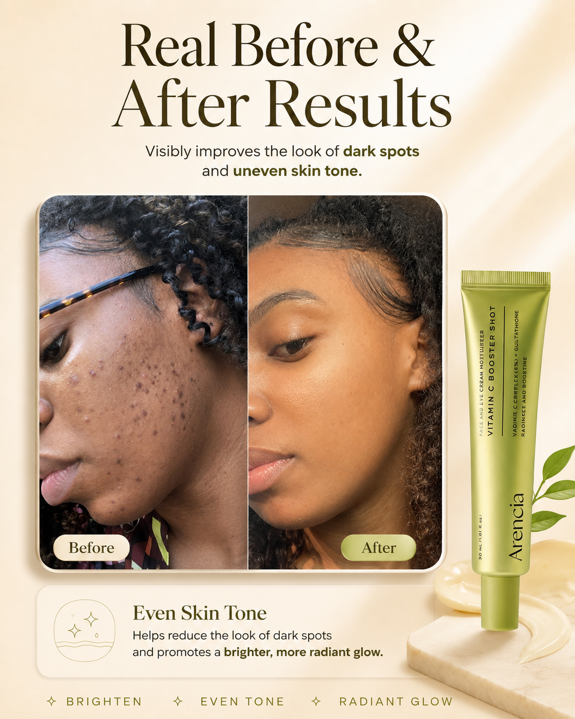 Woman looking closely at uneven-looking skin and post-blemish marks
